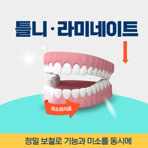 동해치과 동해시 치과 틀니 라미네이트