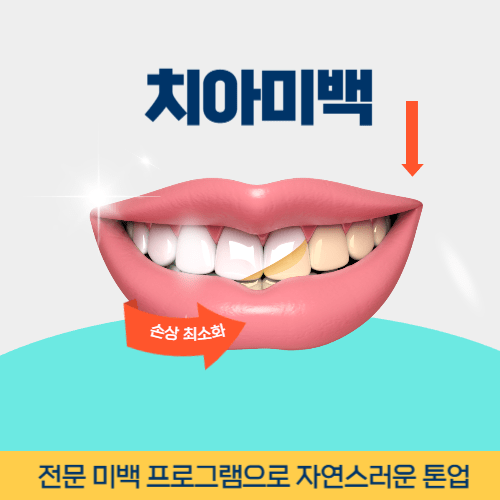 동해치과 동해시 치과 치아미백